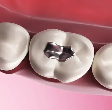 best dental clinic in qatar