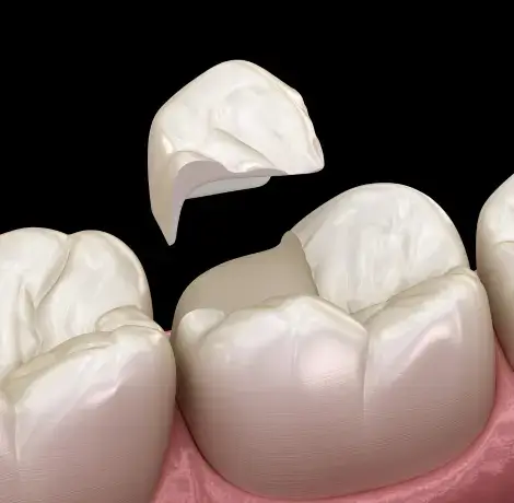 best dental clinic in qatar