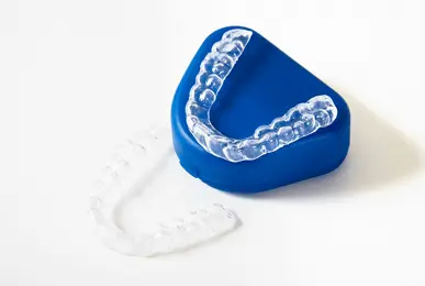 clear aligner