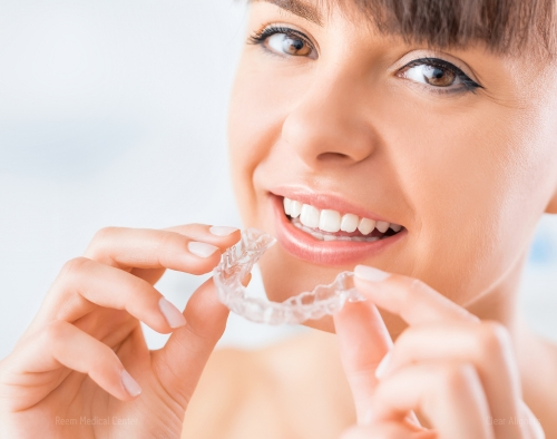 clear aligners