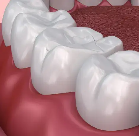 best dental clinic in qatar