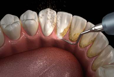Orthodontics