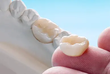 Dental crown and bridge