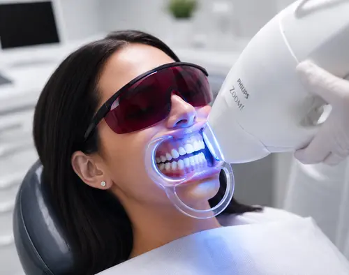 zoom whitening treatment