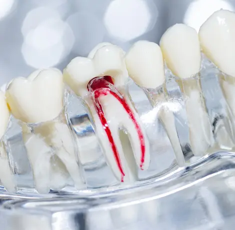 best dental clinic in qatar