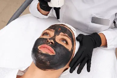 Carbon Laser Treatment