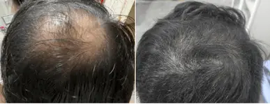 before and after