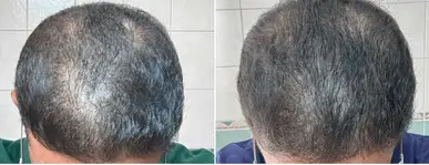 before and after