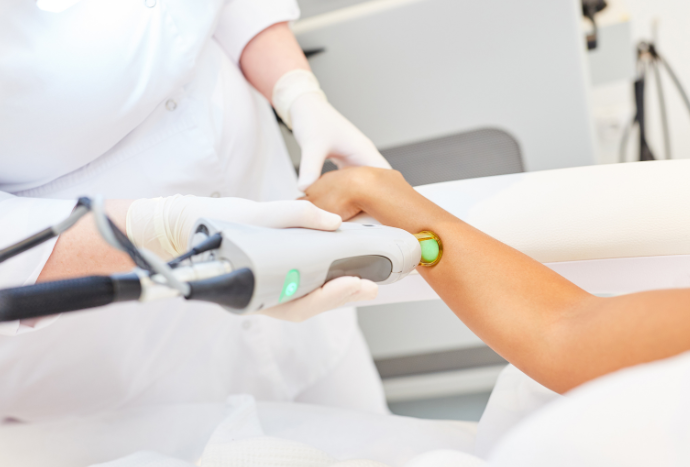 laser hair removal in qatar