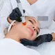 Painless Suction Extraction